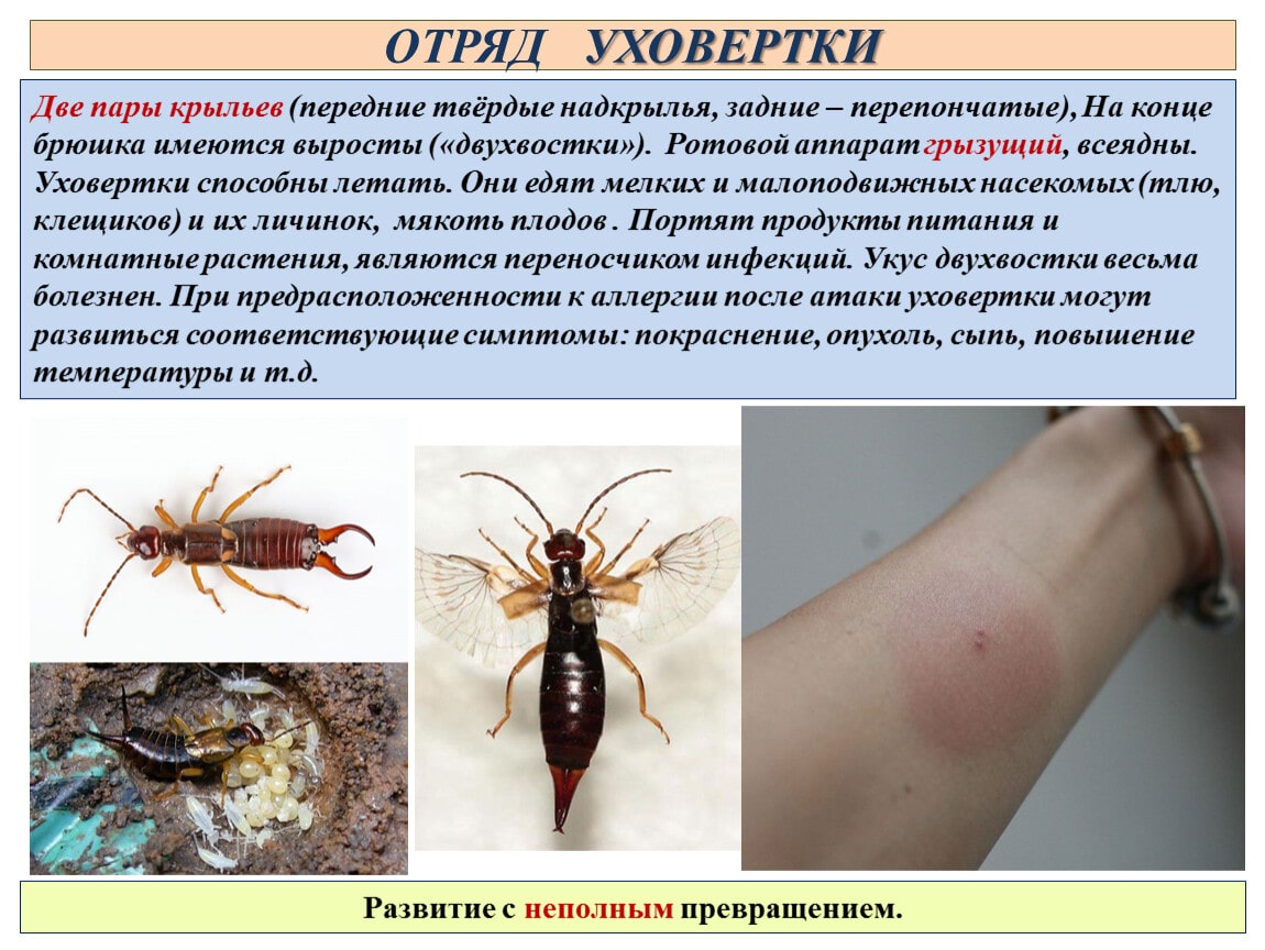 Укус двуххвостки. Двухвостка многоножка. Уховёртка обыкновенная. Жук двухвостка. Укус двуххвостки.